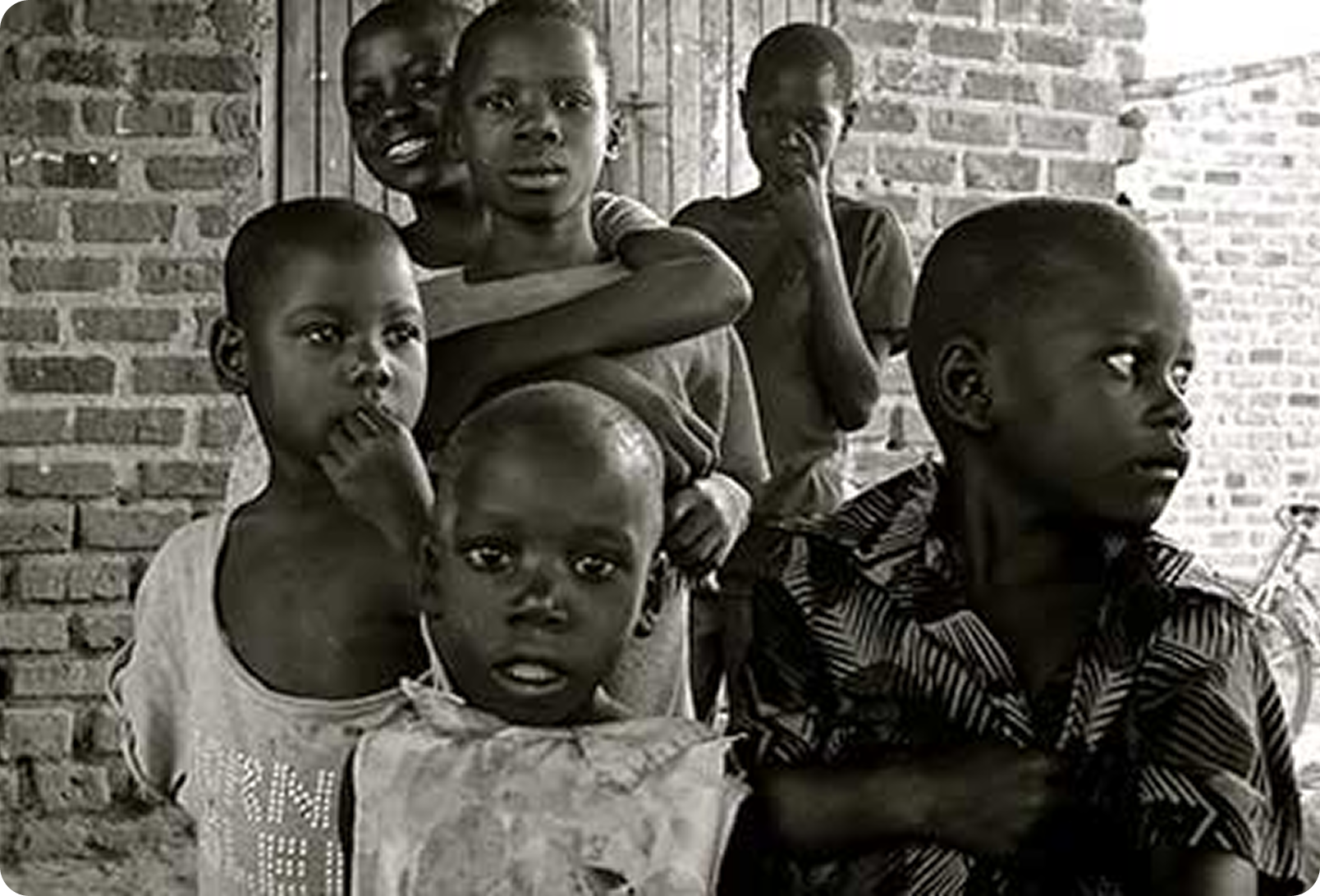 Cataract Eye Operation